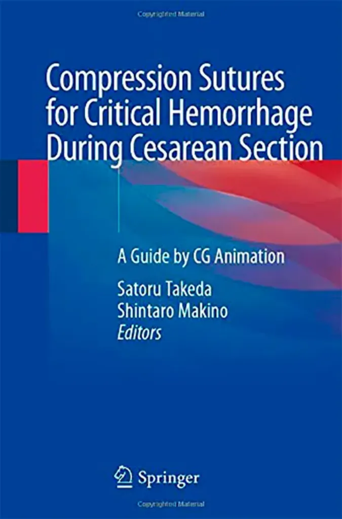 Imagem de Compression Sutures for Critical Hemorrhage During Cesarean Section: A Guide by CG Animation