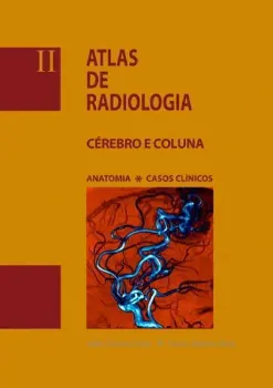 Picture of Book Atlas de Radiologia Cérebro e Coluna Vol. II