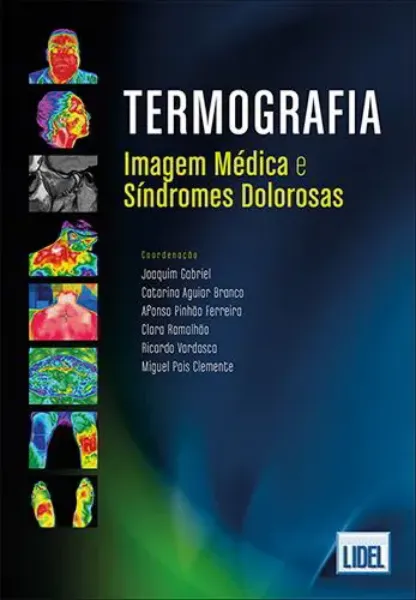 Imagem de Termografia-Imagem Médica Síndromes Dolorosas