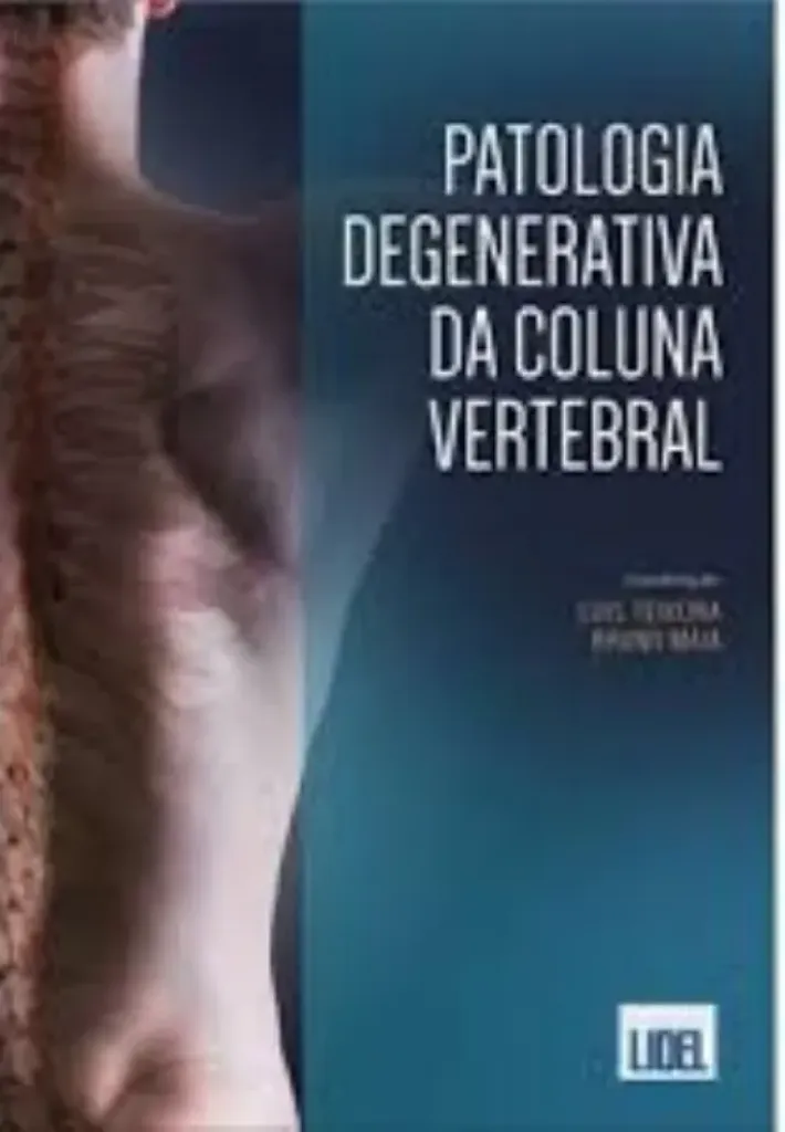 Imagem de Patologia Degenerativa da Coluna Vertebral