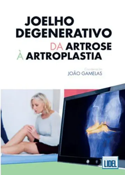 Imagem de Joelho Degenerativo: Da Artrose à Artroplastia