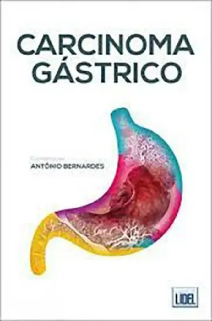 Imagem de Carcinoma Gástrico