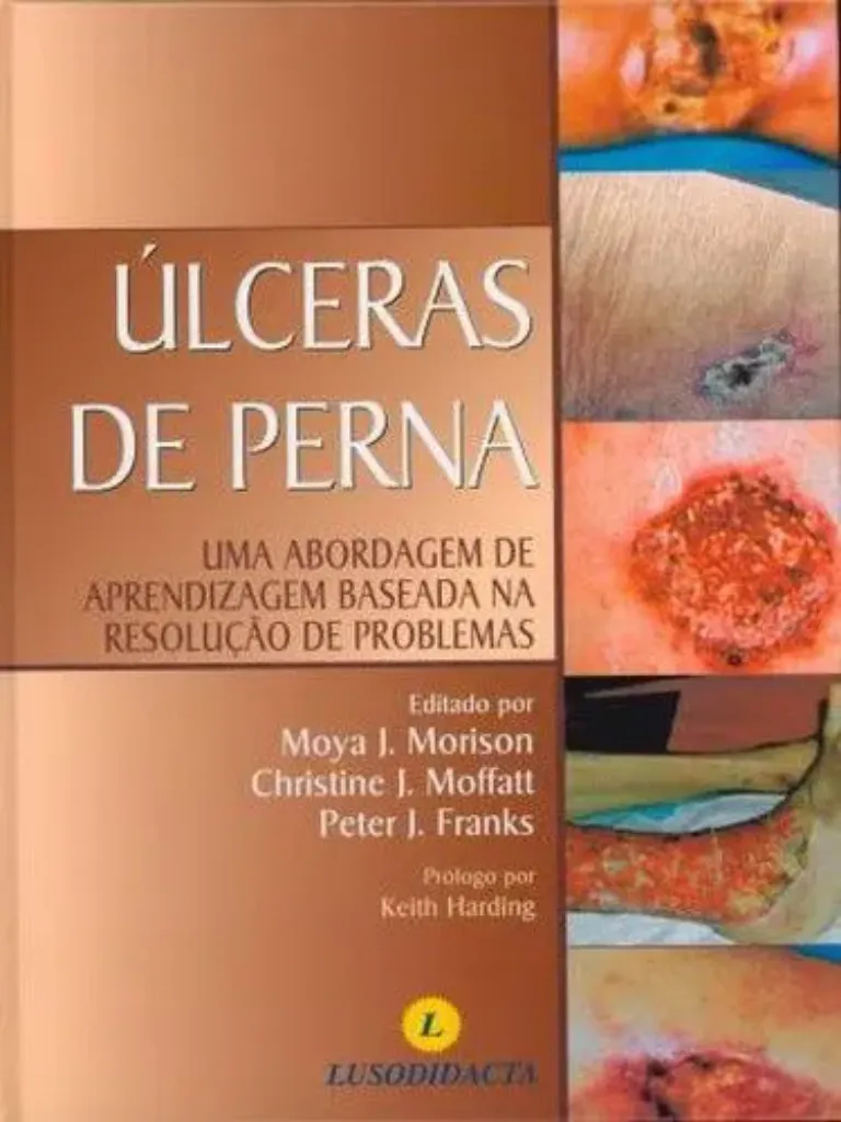 Imagem de Úlceras da Perna - Abordagem de Aprendizagem