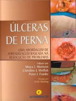 Picture of Book Úlceras da Perna - Abordagem de Aprendizagem