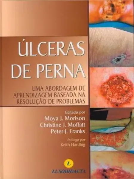 Imagem de Úlceras da Perna - Abordagem de Aprendizagem