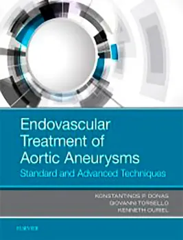 Imagem de Endovascular Treatment of Aortic Aneurysms