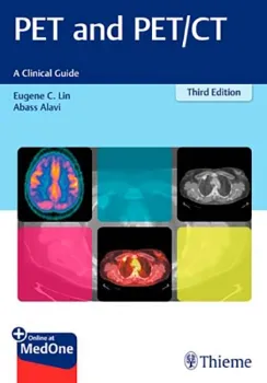 Imagem de PET and PET/CT: A Clinical Guide
