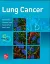 Imagem de Lung Cancer: Standards of Care