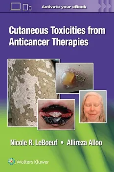 Picture of Book Cutaneous Reactions from Anti-Cancer Therapies