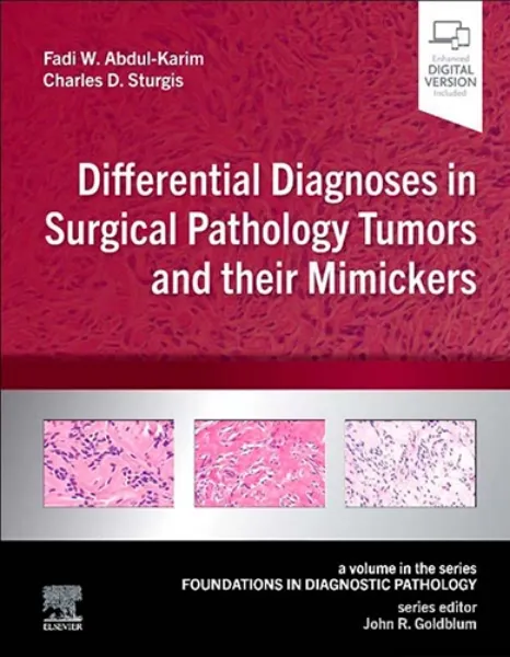 Imagem de Differential Diagnoses in Surgical Pathology Tumors and their Mimickers . A Volume in the Foundations in Diagnostic Pathology series