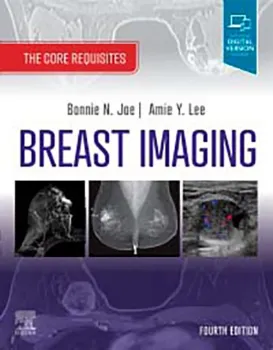 Imagem de Breast Imaging: The Core Requisites