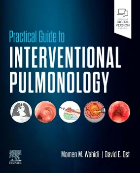 Imagem de Practical Guide to Interventional Pulmonology