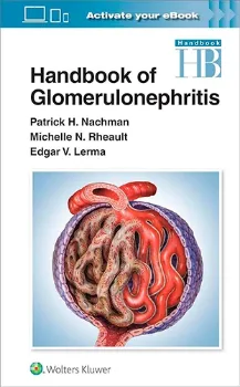 Picture of Book Handbook of Glomerulonephritis
