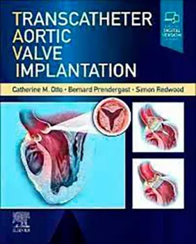 Picture of Book Transcatheter Aortic Valve Implantation
