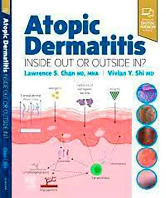 Picture of Book Atopic Dermatitis: Inside Out or Outside In