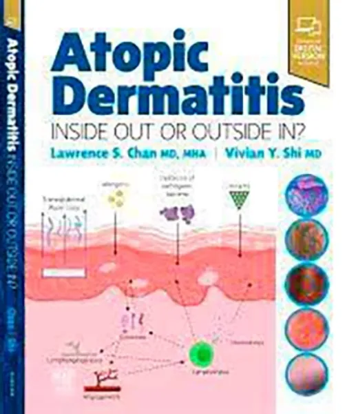 Imagem de Atopic Dermatitis: Inside Out or Outside In