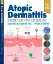 Picture of Book Atopic Dermatitis: Inside Out or Outside In