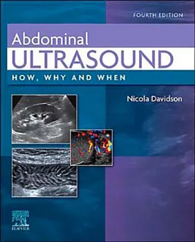 Imagem de Abdominal Ultrasound: How, Why and When