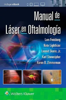 Imagem de Manual de Láser en Oftalmología