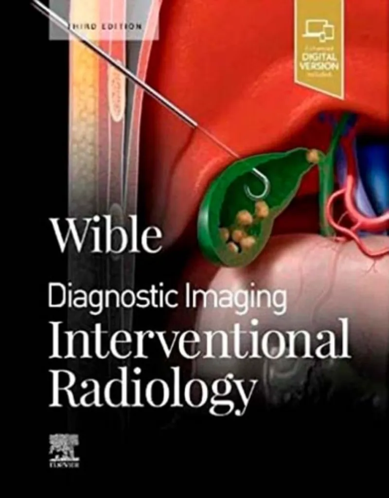 Imagem de Diagnostic Imaging: Interventional Radiology