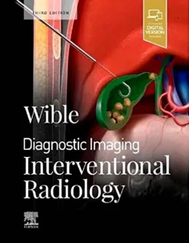 Imagem de Diagnostic Imaging: Interventional Radiology