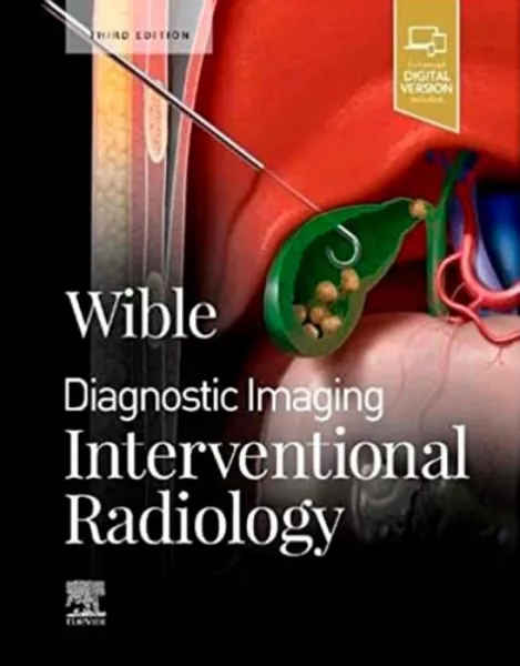 Imagem de Diagnostic Imaging: Interventional Radiology
