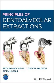 Imagem de Principles of Dentoalveolar Extractions