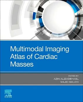 Imagem de Multimodal Imaging Atlas of Cardiac Masses