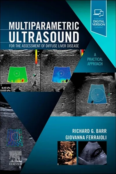 Imagem de Multiparametric Ultrasound for the Assessment of Diffuse Liver Disease
