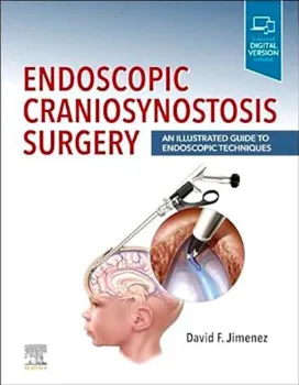 Imagem de Endoscopic Craniosynostosis Surgery: An Illustrated Guide to Endoscopic Techniques