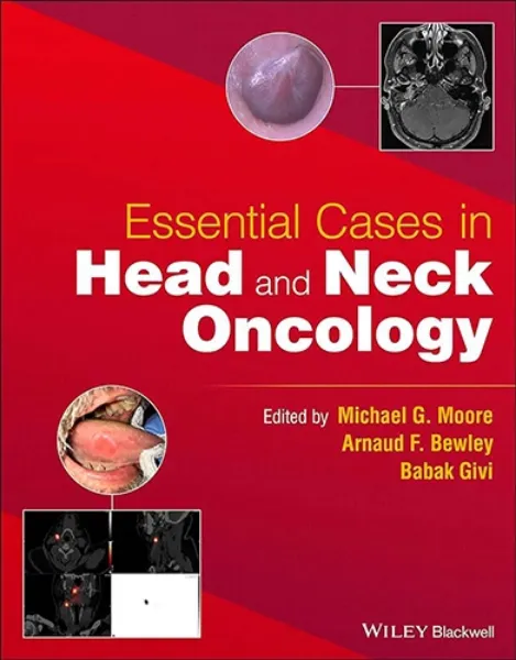 Imagem de Essential Cases in Head and Neck Oncology