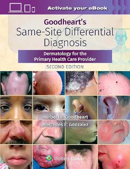 Picture of Book Goodheart's Same-Site Differential Diagnosis: Dermatology for the Primary Health Care Provider