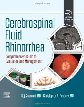 Picture of Book Cerebrospinal Fluid Rhinorrhea: Comprehensive Guide to Evaluation and Management