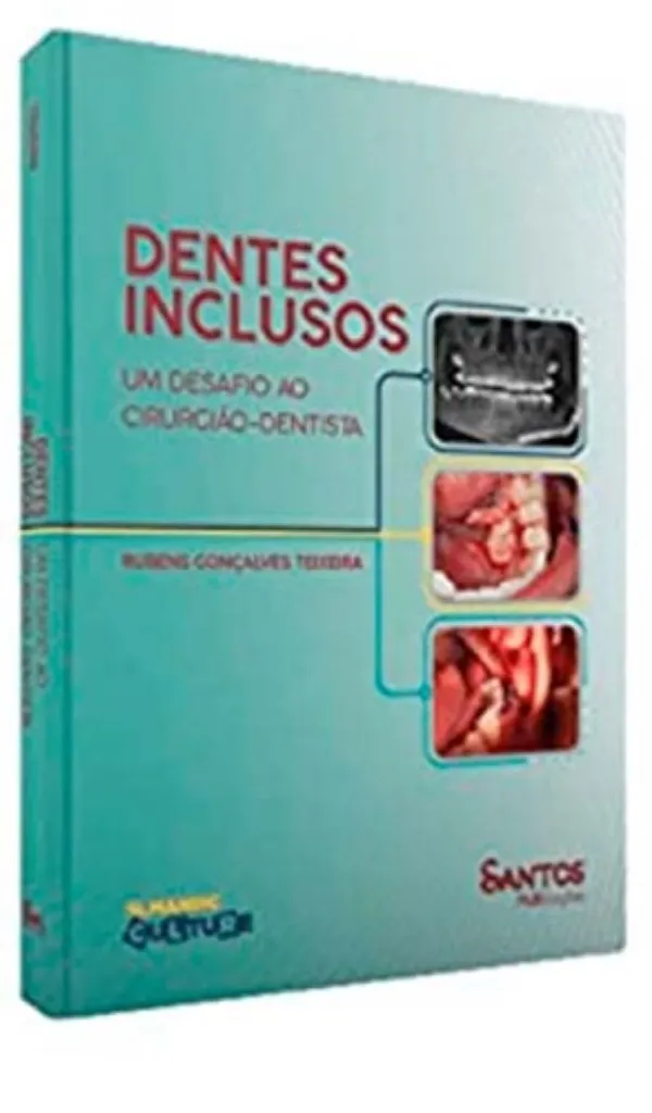 Imagem de Dentes Inclusos: Um Desafio ao Cirurgião-Dentista