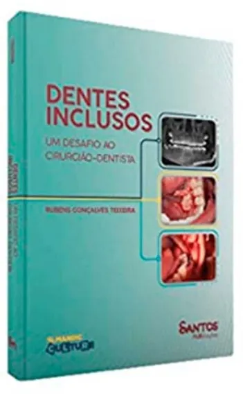 Imagem de Dentes Inclusos: Um Desafio ao Cirurgião-Dentista
