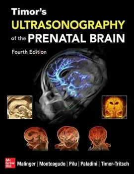 Imagem de Timor's Ultrasonography of the Prenatal Brain