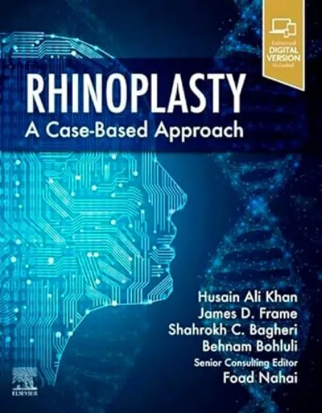 Imagem de Rhinoplasty