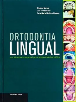 Imagem de Ortodontia Lingual