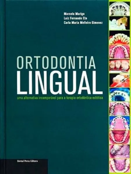 Imagem de Ortodontia Lingual