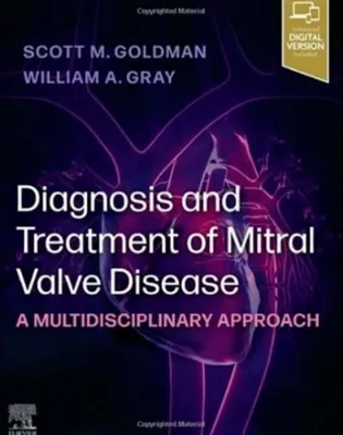 Imagem de Diagnosis and Treatment of Mitral Valve Disease