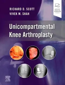 Picture of Book Unicompartmental Knee Arthroplasty