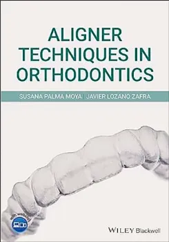 Imagem de Aligner Techniques in Orthodontics
