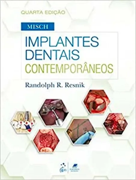 Imagem de Implantes Dentais Contemporâneos