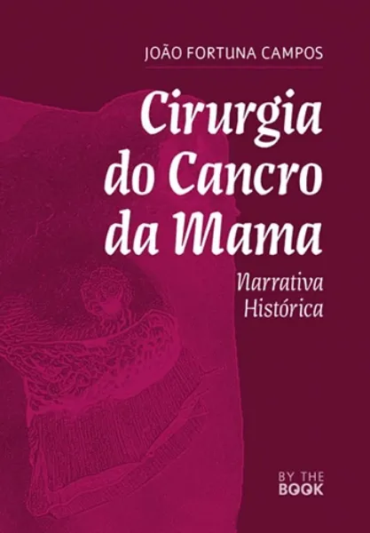 Imagem de Cirurgia do Cancro da Mama - Narrativa Histórica