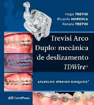 Picture of Book Trevisi Arco Duplo: Mecânica de Deslizamento TDWire