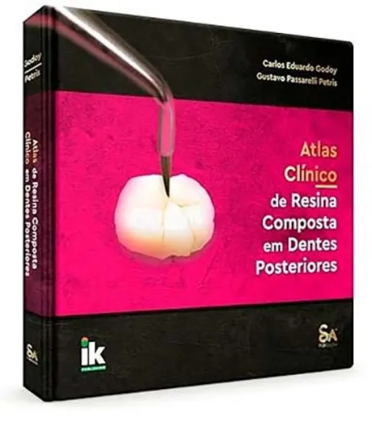 Imagem de Atlas Clínico de Resina Composta em Dentes Posteriores