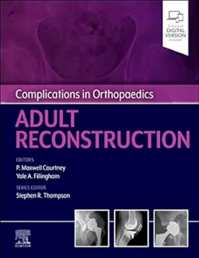 Imagem de Complications in Orthopaedics: Adult Reconstruction