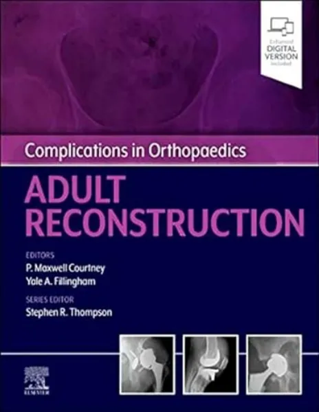 Imagem de Complications in Orthopaedics: Adult Reconstruction