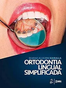 Imagem de Ortodontia Lingual Simplificada