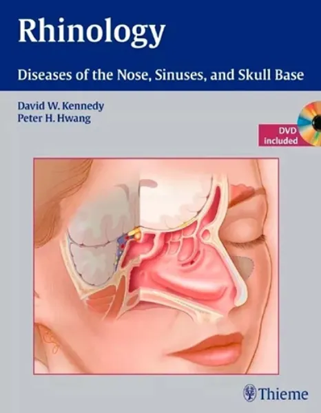 Imagem de Rhinology Diseases Nose Sinuses Skull Base